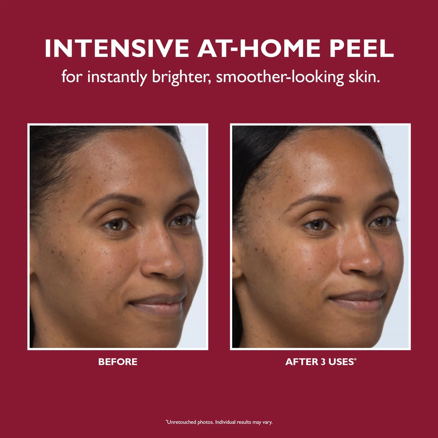 EVEN SMOOTHER INSTANT REVEAL FACIAL PEEL